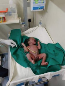 Photo of new born baby in clinic